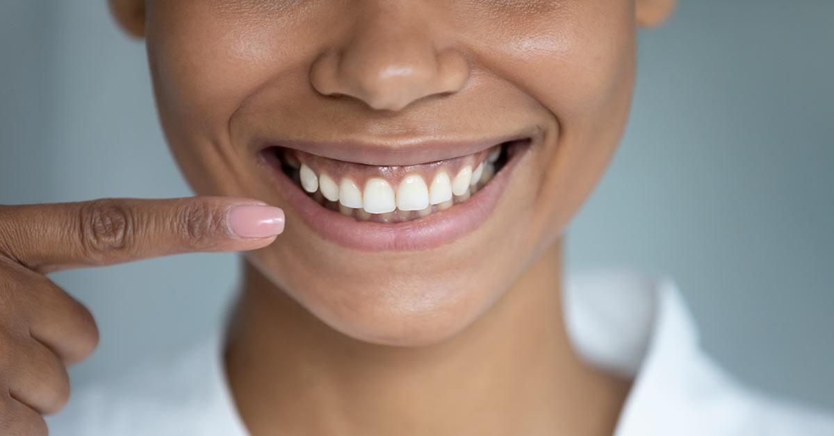 mujer mostrando sonrisa gingival encías