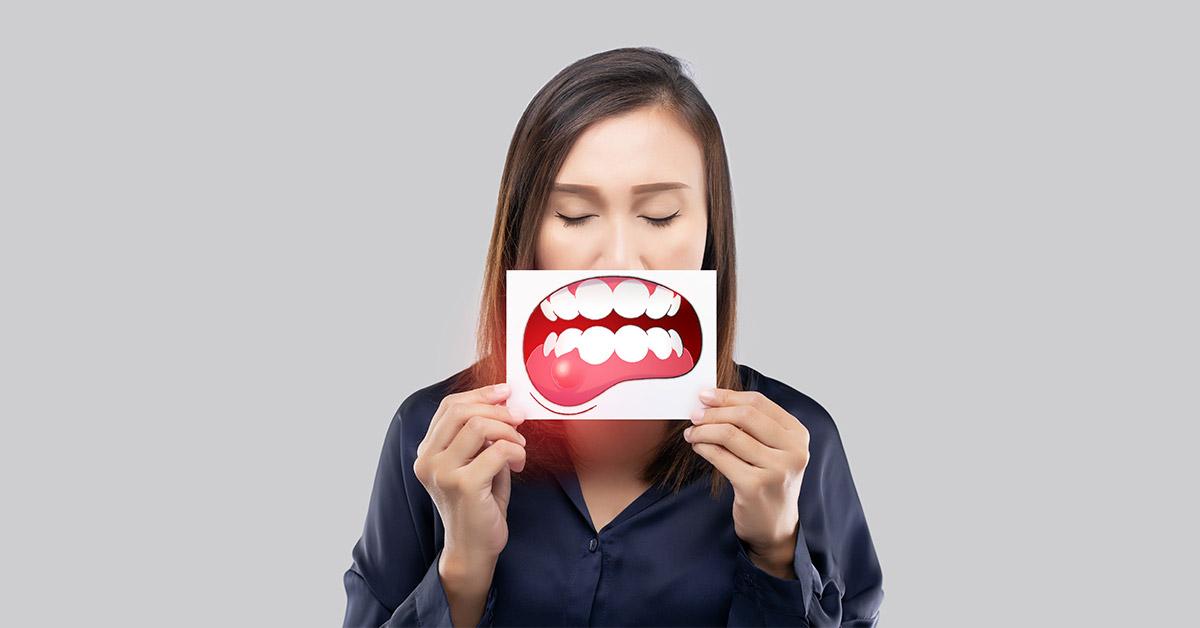 Mujer mostrando fistula dental en la encía