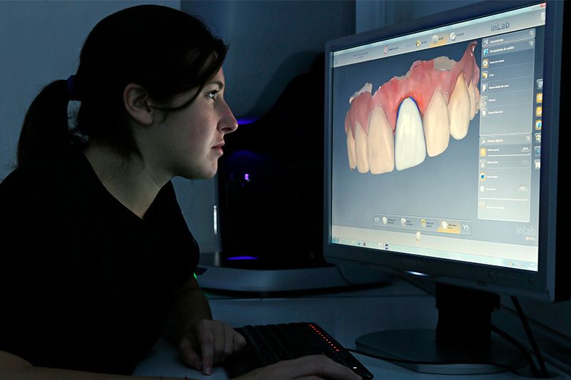 Por qué se rechaza un implante dental