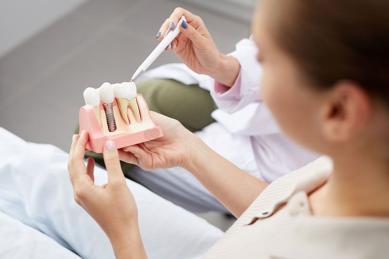 Blog Implantes dentales