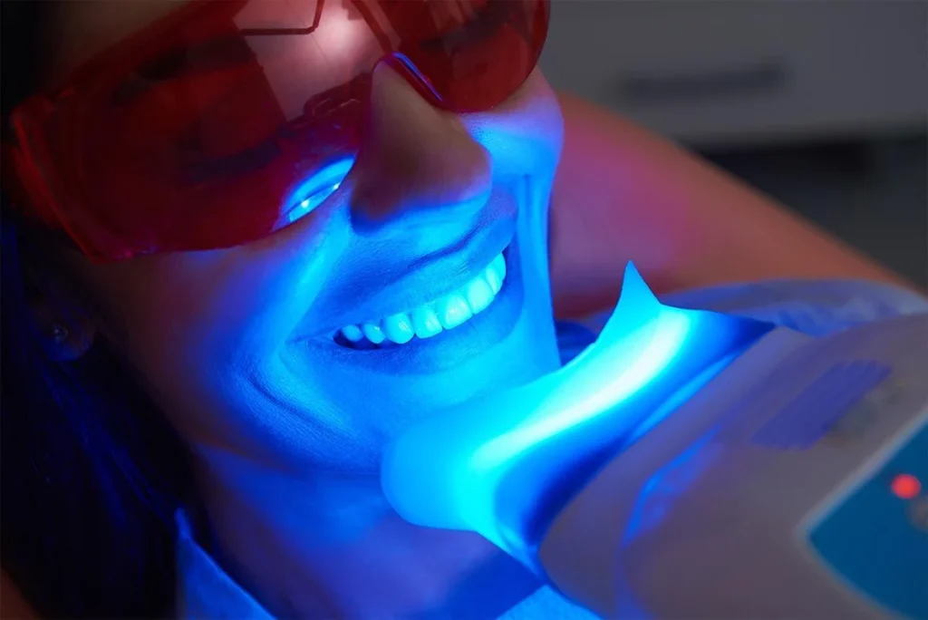 Proceso blanqueamiento dental