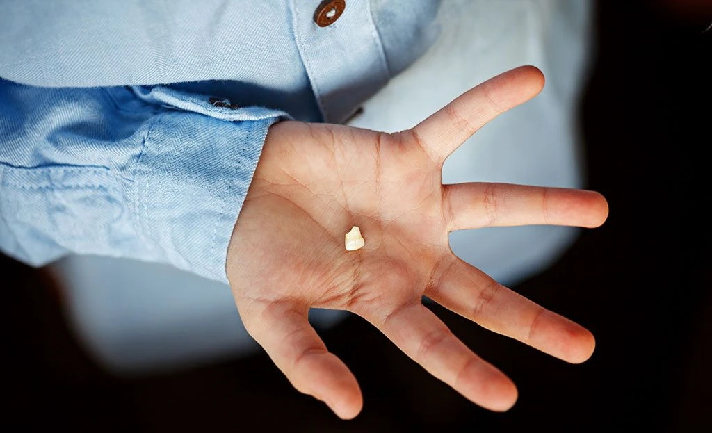 Odontopediatría traumatismos y fracturas