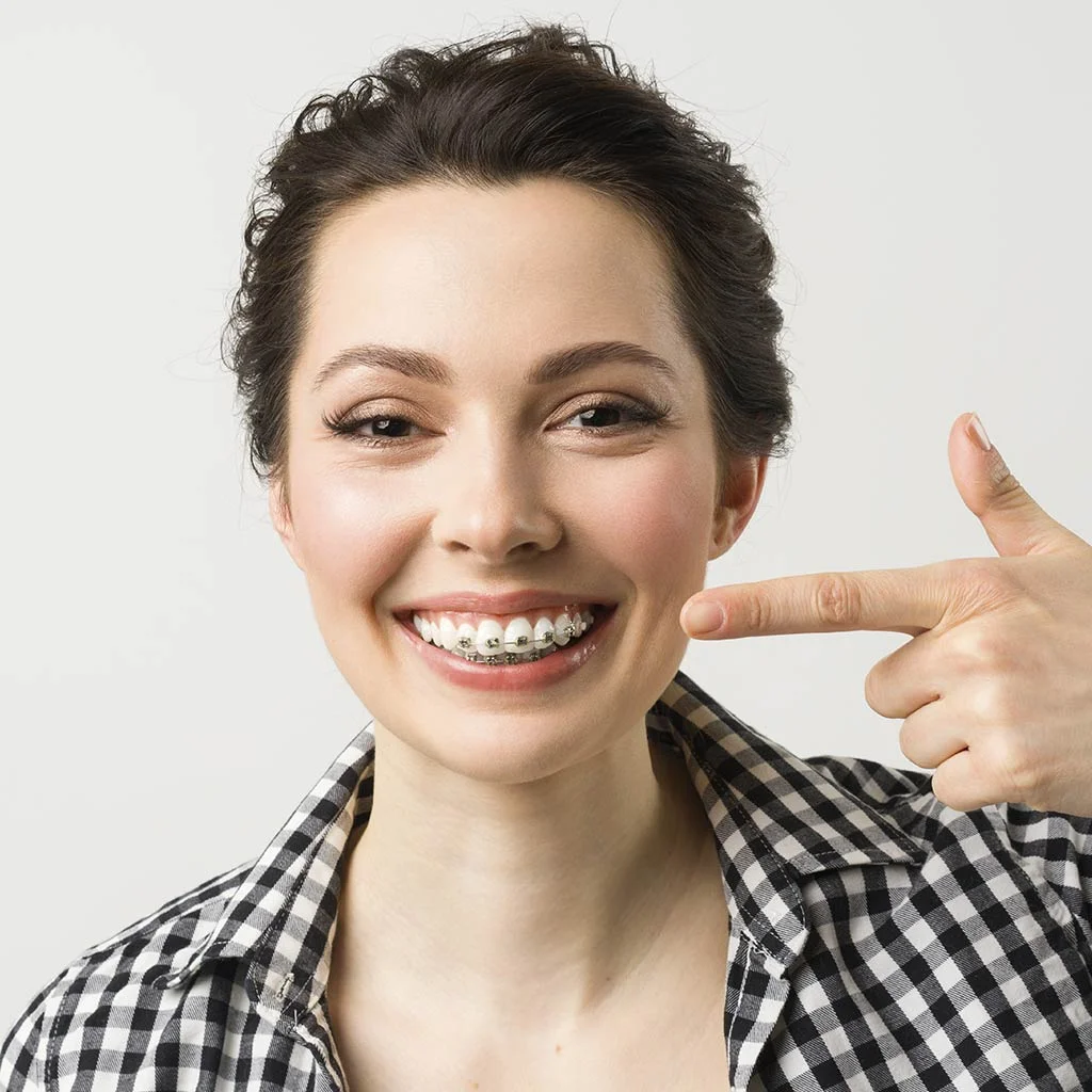 Como funcionan los brackets metálicos