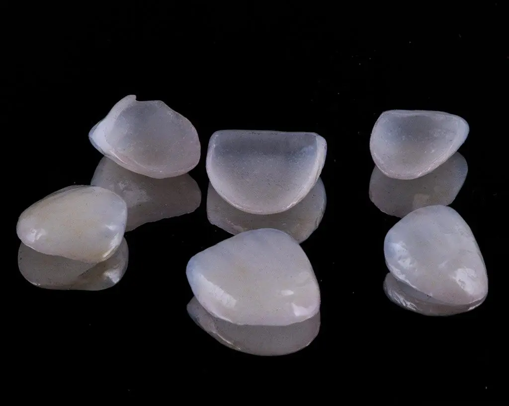 carillas dentales ventajas