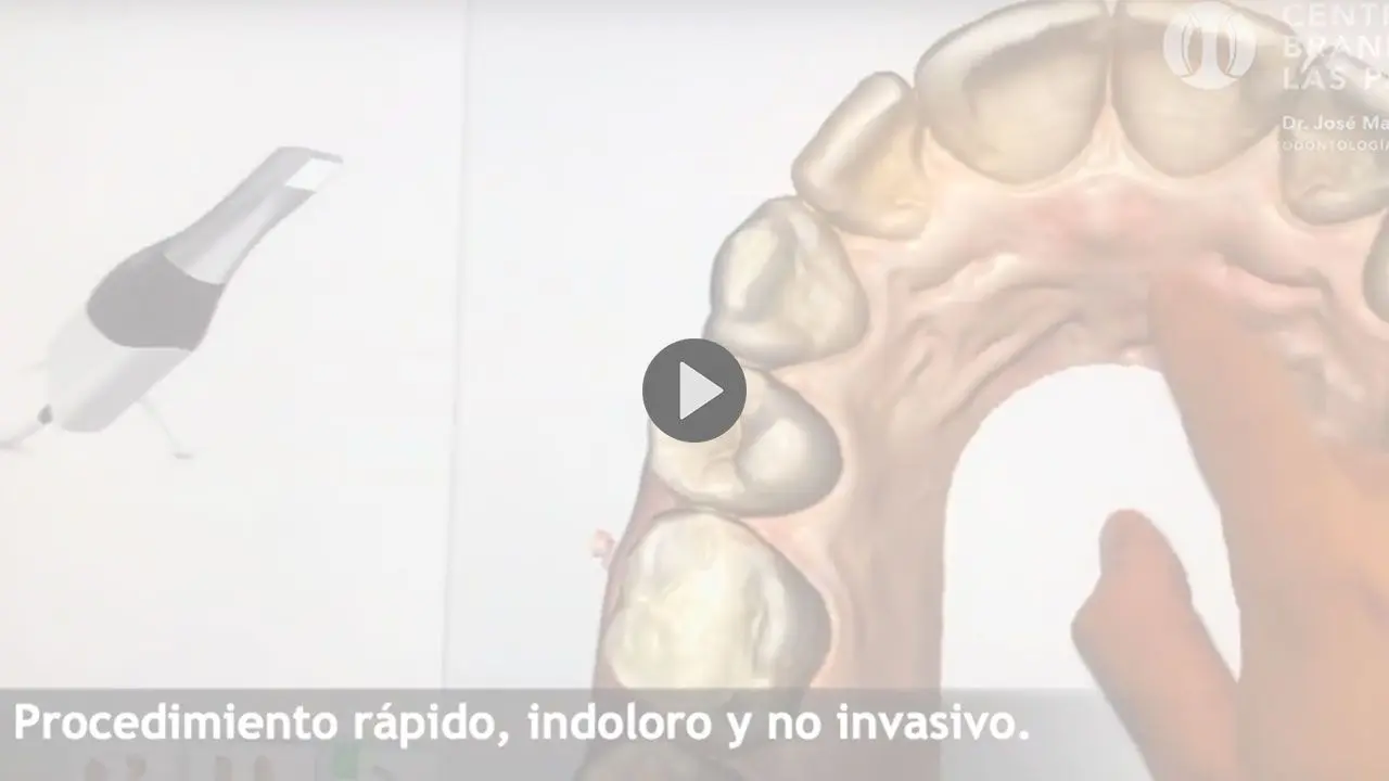 Enlace a video