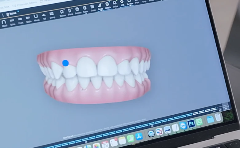 diseño digital de sonrisa