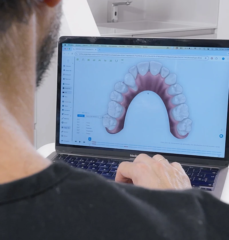 escaner dental antes del tratamiento de ortodoncia